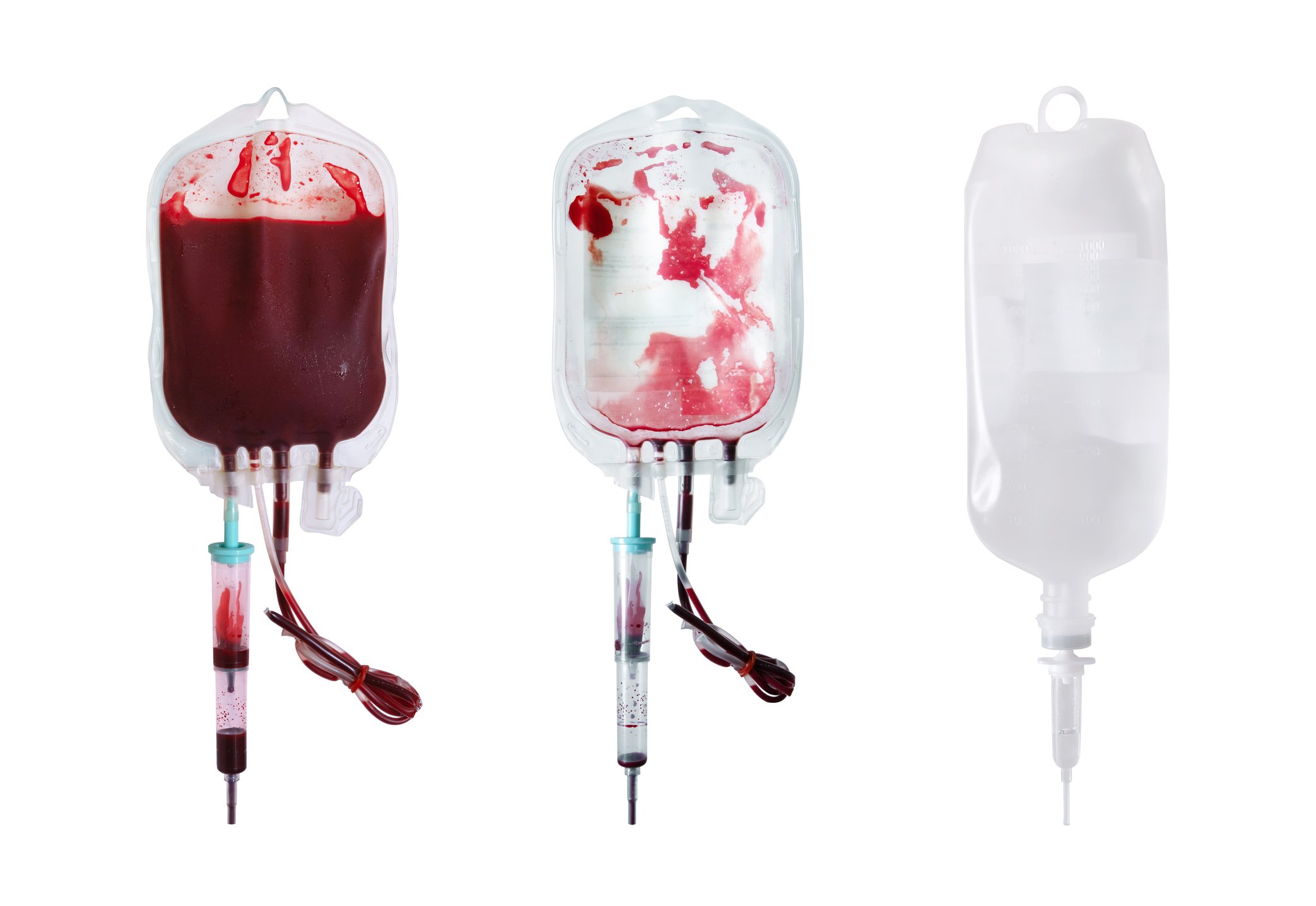 Foto von drei unterschiedlich vollen Blutkonserven